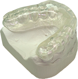 Aufbissschiene